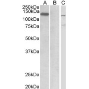 WB analysis of HEK293 lysate (10 µg protein in RIPA buffer) overexpressing Human MIB1 with C-terminal MYC tag probed with E3 Ubiquitin-Protein Ligase MIB1 (MIB1) Antibody (1 µg/ml) in Lane A and probed with anti-MYC tag (1/1000 dilution) in Lane C. Mock transfected HEK293 probed with E3 Ubiquitin-Protein Ligase MIB1 (MIB1) Antibody (1 µg/ml) in Lane B.