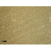 IHC-P analysis of Rat liver tissue, using CCN Family Member 2 (CCN2) Antibody (6 µg/ml).