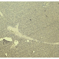 CCN Family Member 2 (CCN2) Antibody