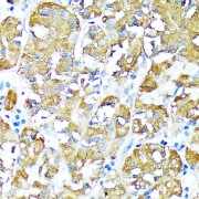 Immunohistochemistry of paraffin-embedded Human stomach using TNFR1 Antibody (1/100 dilution, 40x lens).