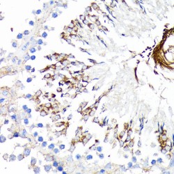 Tumor Necrosis Factor Receptor Superfamily Member 1A / CD120a (TNFRSF1A) Antibody