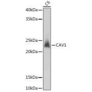 Western blot analysis of extracts of C6 cells using CAV1 Antibody (1/1000 dilution).