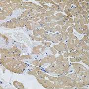 Immunohistochemistry of paraffin-embedded Rat heart using CAST Antibody (1/100 dilution, 40x lens).