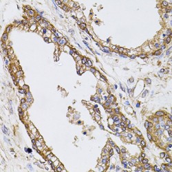 Calpastatin (CAST) Antibody