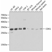 Western blot analysis of extracts of various cell lines using CDK1 Antibody (1/1000 dilution).