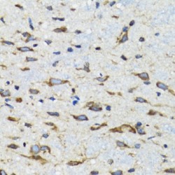 Cyclin-Dependent Kinase 1 (CDK1) Antibody