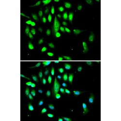 Cyclin-Dependent Kinase 1 (CDK1) Antibody