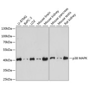 Western blot analysis of extracts of various cell lines using p38 MAPK Antibody (1/1000 dilution).