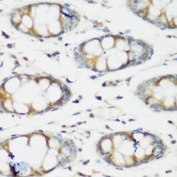 Bone Morphogenetic Protein 2 (BMP2) Antibody