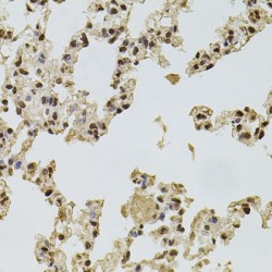 Fibroblast Growth Factor 2 (FGF2) Antibody