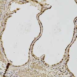 Fibroblast Growth Factor 2 (FGF2) Antibody