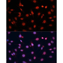 Fibroblast Growth Factor 2 (FGF2) Antibody