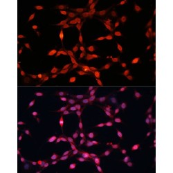 Fibroblast Growth Factor 2 (FGF2) Antibody