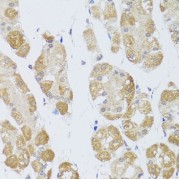 Immunohistochemistry of paraffin-embedded Human stomach using HDAC4 Antibody (1/100 dilution, 40x lens).