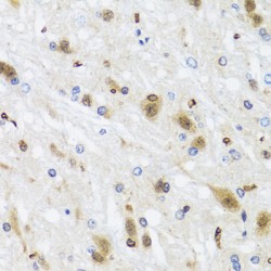 Histone Deacetylase 4 (HDAC4) Antibody