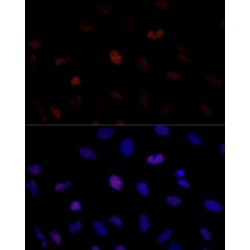 Proteasome Activator Subunit 3 (PSME3) Antibody