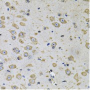 Immunohistochemistry of paraffin-embedded Rat brain using RhoA Antibody (1/100 dilution, 40x lens).