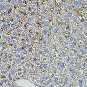 Immunohistochemistry of paraffin-embedded Mouse liver using TGFA Antibody