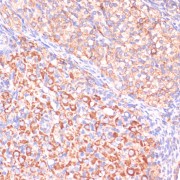 Immunohistochemistry of paraffin-embedded Rat ovary using VHL Antibody (1/200 dilution, 40x lens).