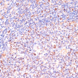 Von Hippel-Lindau Disease Tumor Suppressor (VHL) Antibody