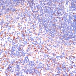 Von Hippel-Lindau Disease Tumor Suppressor (VHL) Antibody