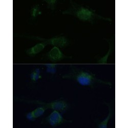 Von Hippel-Lindau Disease Tumor Suppressor (VHL) Antibody