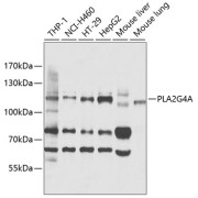 Western blot analysis of extracts of various cell lines using PLA2G4A Antibody (1/1000 dilution).