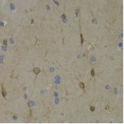 Immunohistochemistry of paraffin-embedded Rat brain using WNT3A Antibody (1/200 dilution, 40x lens).