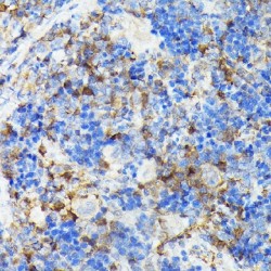 Tyrosine-Protein Kinase CSK (CSK) Antibody