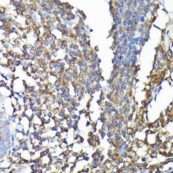 Tyrosine-Protein Kinase CSK (CSK) Antibody