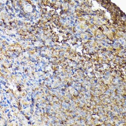 Tyrosine-Protein Kinase CSK (CSK) Antibody