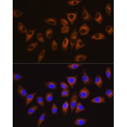 Tyrosine-Protein Kinase CSK (CSK) Antibody