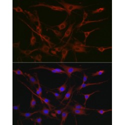 Tyrosine-Protein Kinase CSK (CSK) Antibody