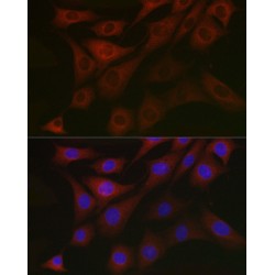 Pyruvate Dehydrogenase Kinase Isozyme 1 (PDK1) Antibody