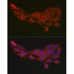 Pyruvate Dehydrogenase Kinase Isozyme 1 (PDK1) Antibody