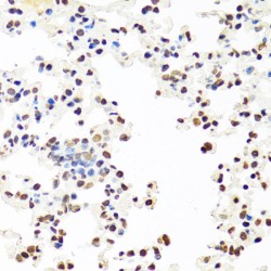 Splicing Factor Proline And Glutamine Rich (SFPQ) Antibody