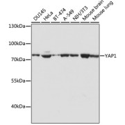 Western blot analysis of extracts of various cell lines using YAP1 Antibody (1/1000 dilution).