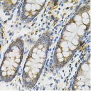 Immunohistochemistry of paraffin-embedded Human colon using DEFB132 Antibody (1/100 dilution, 40x lens).