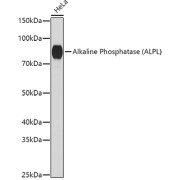 Western blot analysis of extracts of HeLa cells using Alkaline Phosphatase Antibody (1/1000 dilution).