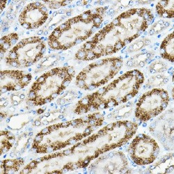 Alkaline Phosphatase, Tissue-Nonspecific Isozyme (ALPL) Antibody