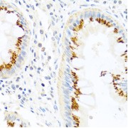 Immunohistochemistry of paraffin-embedded Human colon using FAM3B Antibody (1/100 dilution, 40x lens).