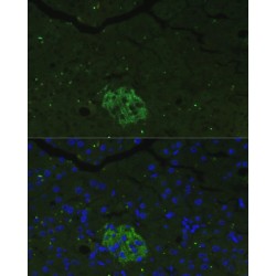 Protein FAM3B (FAM3B) Antibody