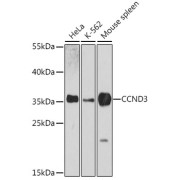 Western blot analysis of extracts of various cell lines using CCND3 Antibody (1/3000 dilution).