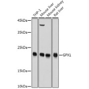 Western blot analysis of extracts of various cell lines using GPX1 Antibody (1/1000 dilution).