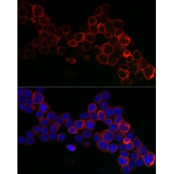 Glutathione Peroxidase 1 (GPX1) Antibody