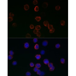 Glutathione Peroxidase 1 (GPX1) Antibody