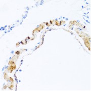 Immunohistochemistry of paraffin-embedded Rat lung using PHPT1 Antibody (1/100 dilution, 40x lens).