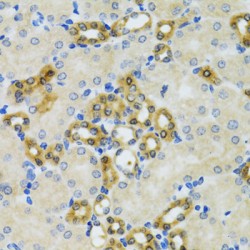 Phosphohistidine Phosphatase 1 (PHPT1) Antibody