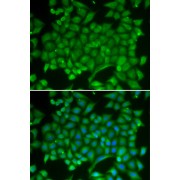 Immunofluorescence analysis of MCF-7 cells using RAB11A Antibody