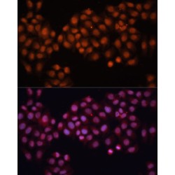 Cell Division Cycle 25A (CDC25A) Antibody